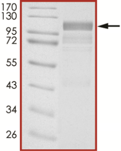 EGFR, Active with mCherry